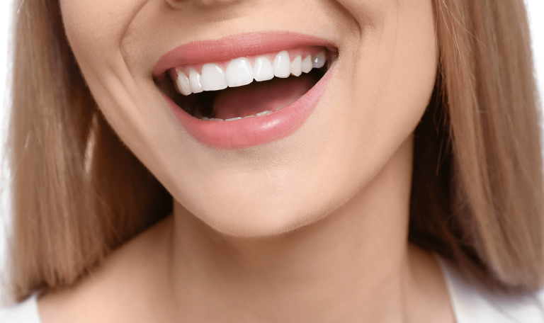 Mükemmel Beyaz Dişlere Sahip Bir Kadının Özgüvenli Gülümsemesi