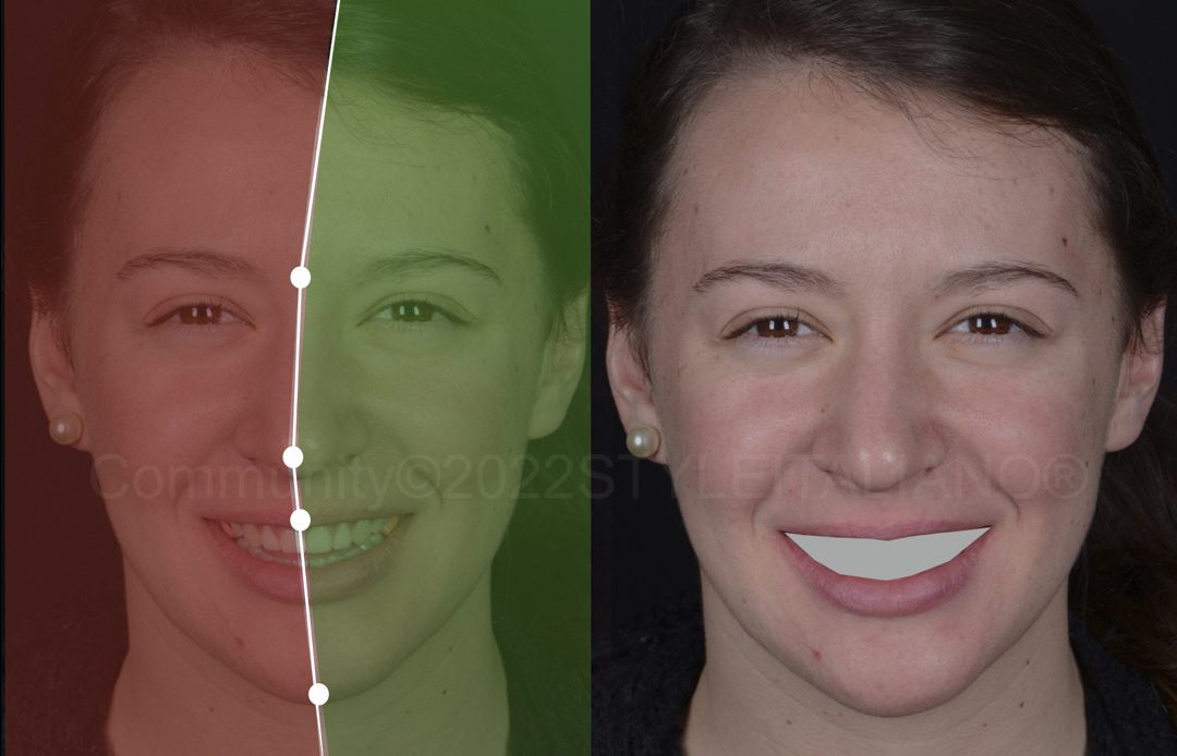 Bir Diş Hekiminin, Hastanın Yüz Oranlarını Dijital Bir Ekran Üzerinde Analiz Ettiği An.