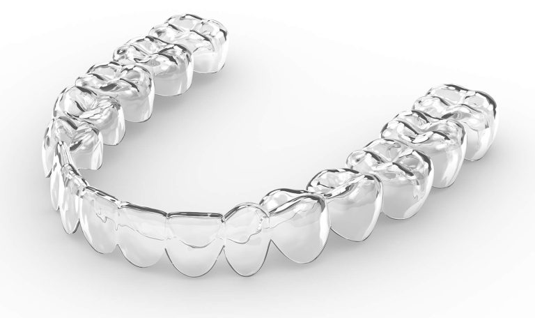 Diş Teli Ve Şeffaf Plak Tedavi Seçeneklerini Yan Yana Gösteren, Iki Farklı Ağız Görüntüsü.