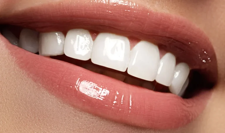 Estetik Diş Tedavisinde Kullanılan Zirkonyum Kaplama Ve Lamine Veneer Örnekleri.