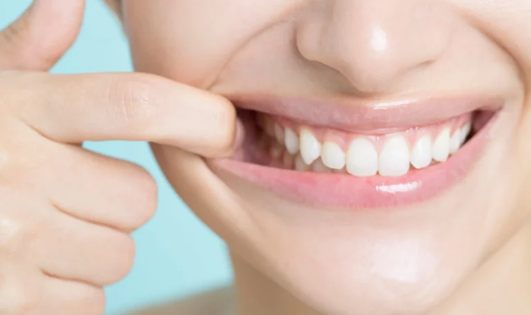 Diş Beyazlatma Işlemi Yapılan Bir Hastanın Ağız Içi Görüntüsü, Diş Hekiminin Elinde Beyazlatma Jeli