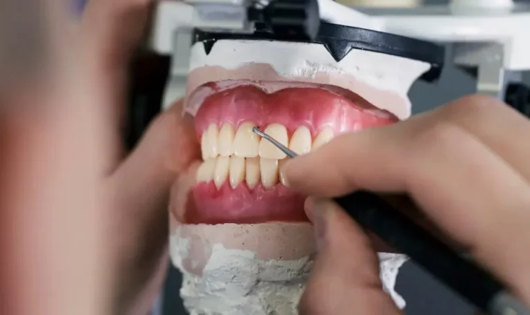 Diş Estetiği Öncesi Ve Sonrası Fotoğrafların Karşılaştırıldığı Bir Hasta Profili