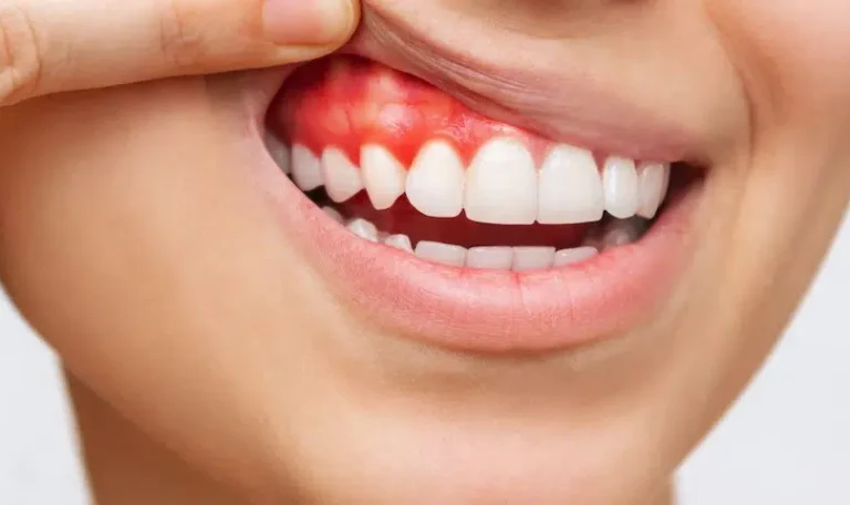 Diş Fırçalarken Diş Eti Kanaması Yaşayan Bir Kişinin Banyoda Aynaya Baktığı Yakın Çekim Görüntüsü