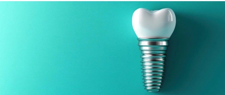 Ankara’daki Modern Bir Diş Kliniğinde, Diş Hekimi Hastaya Alman Marka Implantların Fiyat Ve Tedavi Seçeneklerini Bilgisayar Ekranı Üzerinden Anlatıyor.