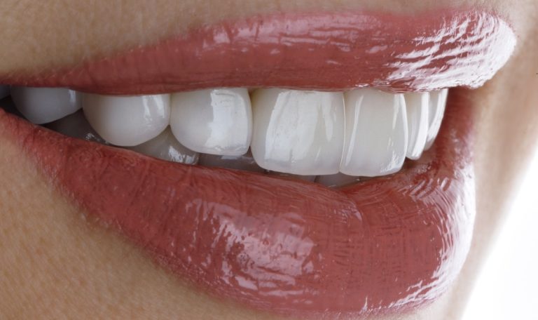 Zirkonyum Ve Porselen Diş Kaplamalarının Karşılaştırıldığı, Avantajları Ve Dezavantajları Hakkında Bilgilendiren Bir Görsel.