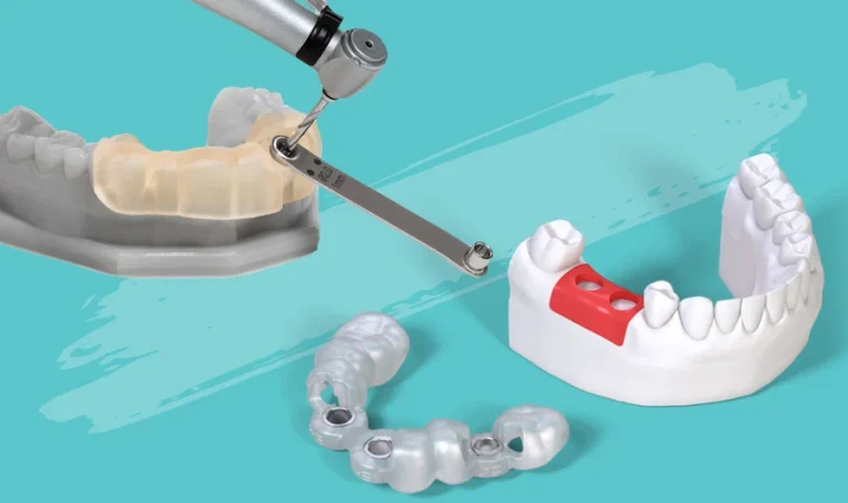 Ankara’da Dikişsiz Implant Tedavisi Hakkında Hastasına Bilgi Veren Diş Hekimi Ve Dijital Planlama Görüntüleri