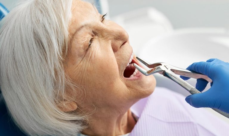 Ankara’da Implant Için Yaş Sınırı Olup Olmadığını Diş Hekimine Soran Orta Yaşlı Hasta