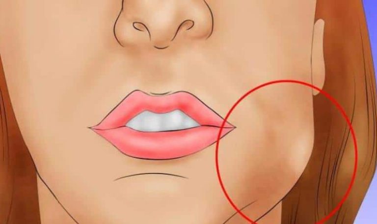 Ankara’da Implant Sonrası Yaşadığı Şişlik Ve Ağrı Hakkında Diş Hekiminden Bilgi Alan Hasta