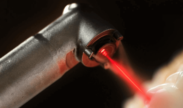 Ankara Lazerle Implant Tedavisi