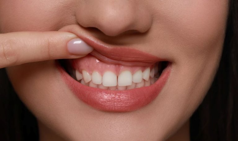 Gulus Estetigi Kimler Icin Uygundur Sureci Ve Avantajlari 1