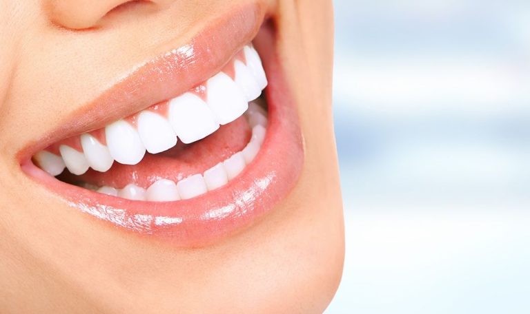 Gulus Tasarimi Oncesi Ve Sonrasi Farki