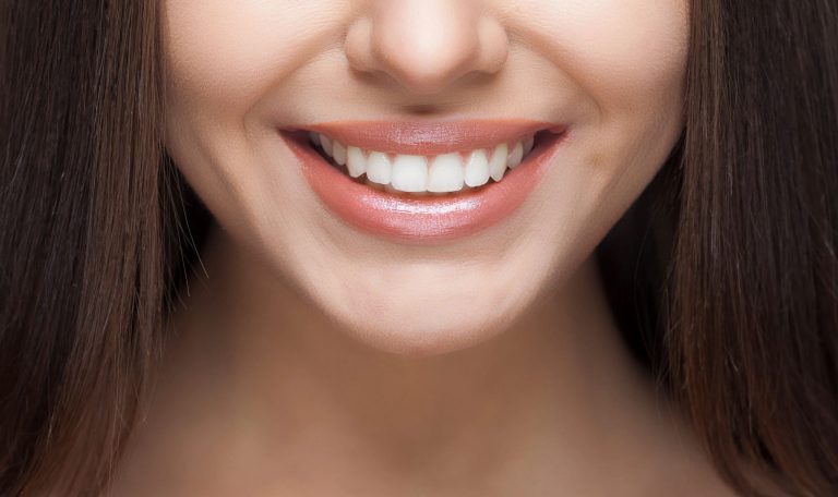 Minimal Mudahale Ile Maksimum Estetik Smile Design Nedir