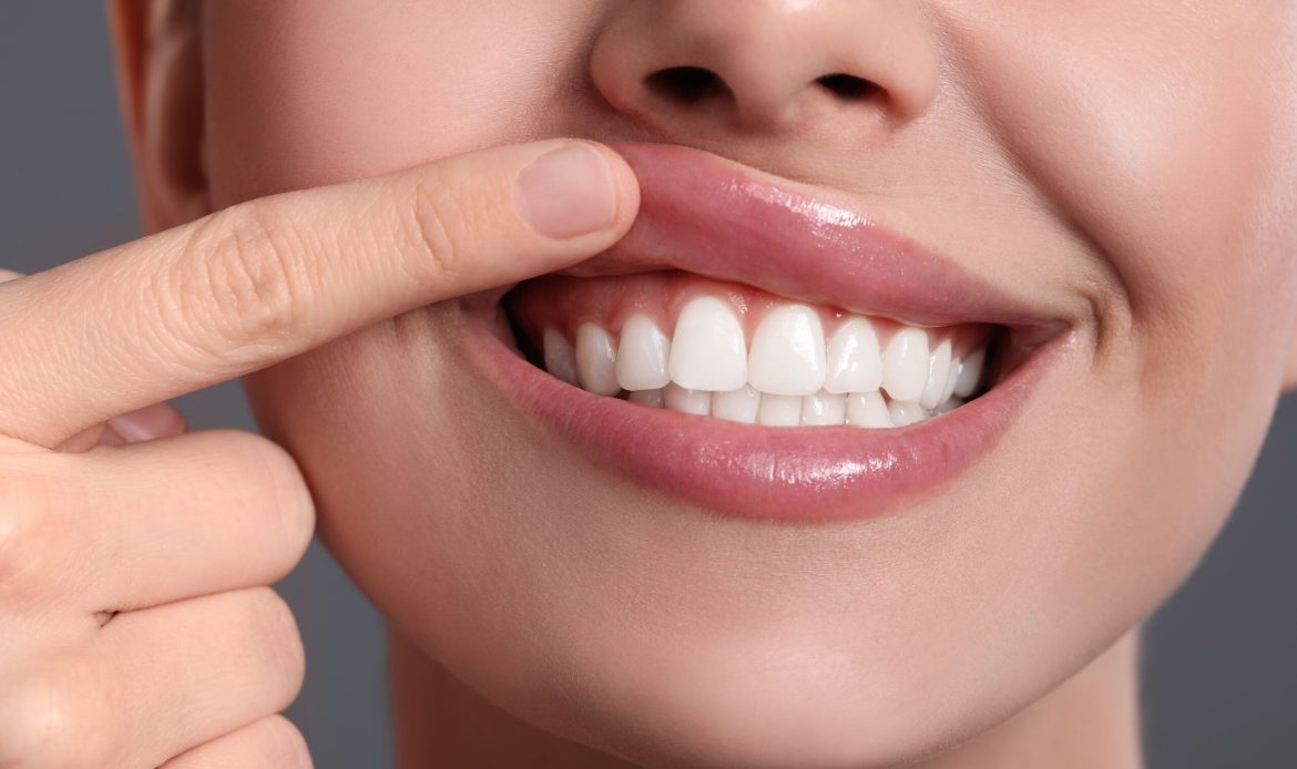Gulus Tasarimi Oncesi Hangi Tedaviler Gerekir